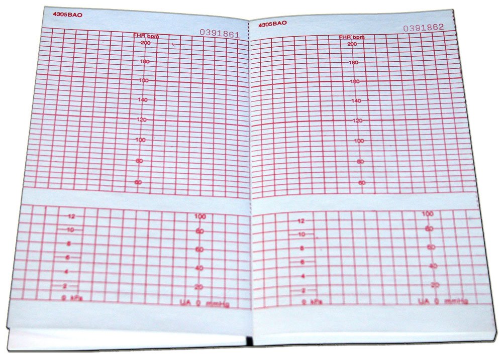 COROMETRICS ECG PAPER