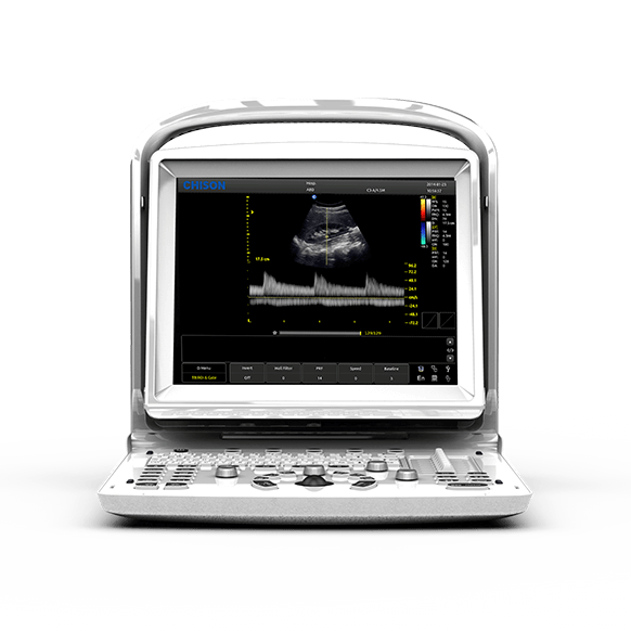 CHISON ECO3 EXPERT- ULTRASOUND SYSTEM