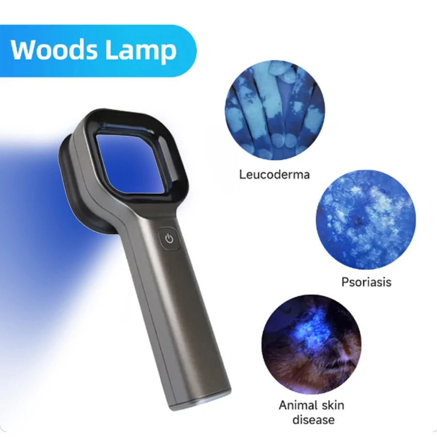 YONKER WOOD'S LAMP SKIN ANALYZER